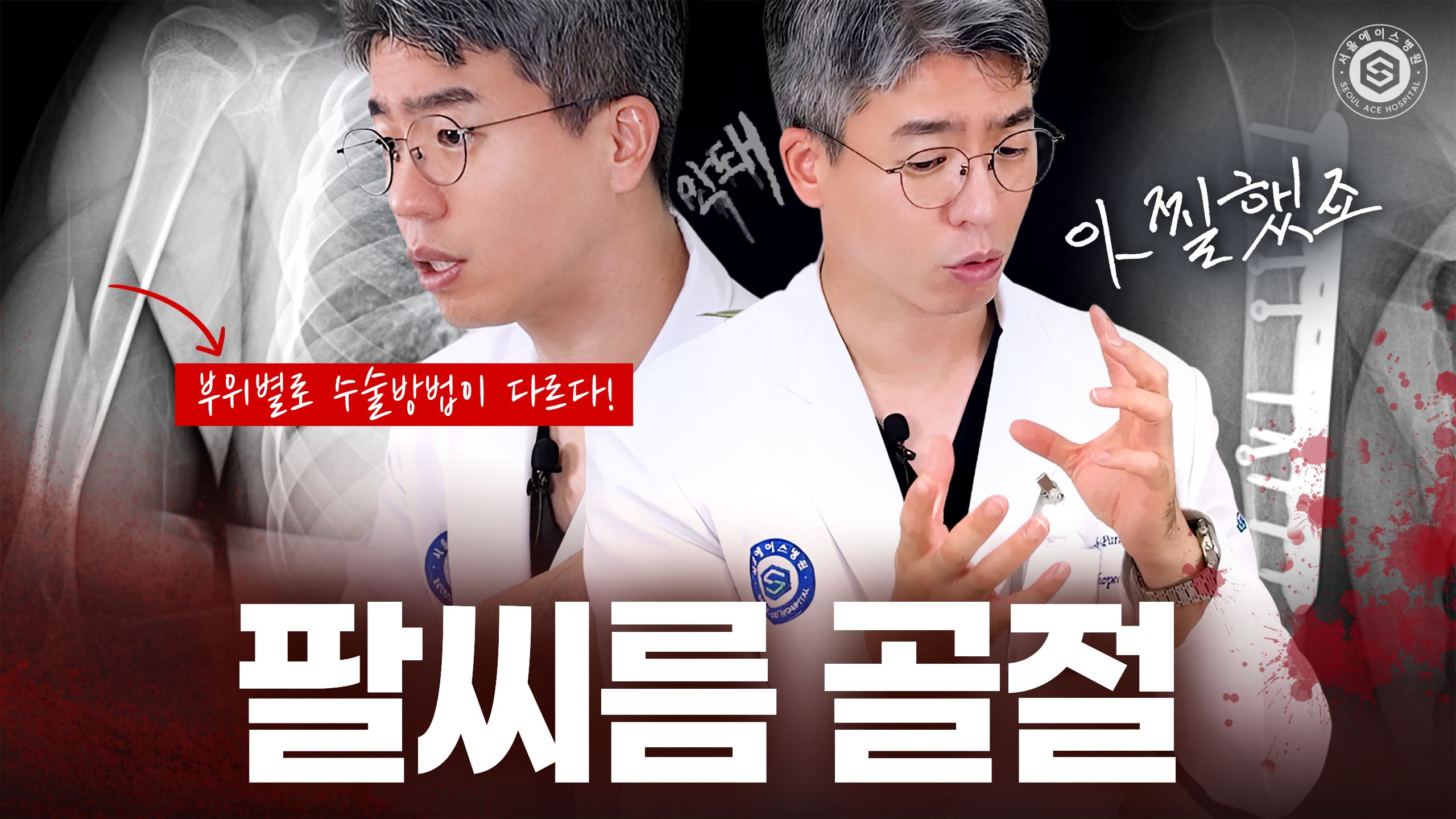 팔씨름 골절